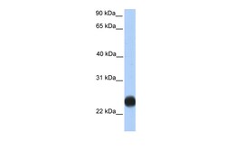 Aviva Systems Biology Corp TMEM123 Antibody - C-terminal region (ARP50227_P050)