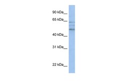 Aviva Systems Biology Corp ZMYND17 Antibody - C-terminal region (ARP50392_P050)