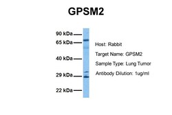 Aviva Systems Biology Corp GPSM2 Antibody - N-terminal region (ARP51303_P050)