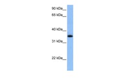 Aviva Systems Biology Corp CHN2 Antibody - N-terminal region (ARP51862_P050)