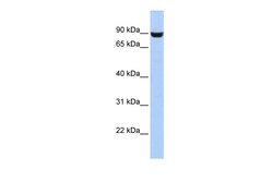 Aviva Systems Biology Corp LRFN5 Antibody - middle region (ARP52979_P050)