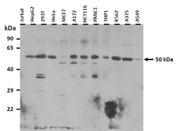Aviva Systems Biology Corp TUBA3C Antibody - N-terminal region (ARP53650_P050)