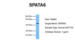 Aviva Systems Biology Corp SPATA6 Antibody - middle region (ARP53736_P050)