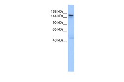 Aviva Systems Biology Corp TEX14 Antibody - C-terminal region (ARP53844_P050)