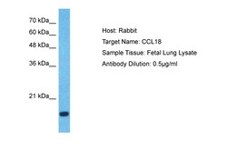 Aviva Systems Biology Corp CCL18 Antibody - middle region (AVARP07049_P050)