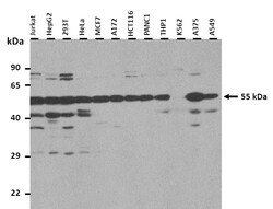 Aviva Systems Biology Corp CHRNA9 Antibody - N-terminal region (AVARP13019_P050)