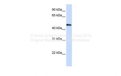 Aviva Systems Biology Corp CSDA Antibody - C-terminal region (P100917_T100)