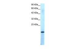 Aviva Systems Biology Corp PC4 Antibody - middle region (P100960_T100)