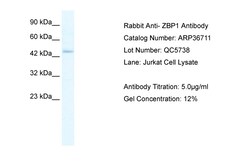 Aviva Systems Biology Corp ZBP1 Antibody - middle region (ARP36711_T100)