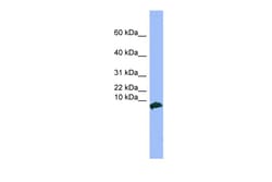 Aviva Systems Biology Corp VIP Antibody - middle region (ARP45465_P050)