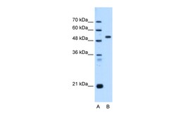 Aviva Systems Biology Corp ST14 Antibody - C-terminal region (ARP48056_P050)
