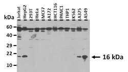 Aviva Systems Biology Corp ATP6V0C Antibody - middle region (ARP45161_P050)