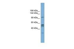 Aviva Systems Biology Corp ANO6 Antibody -C-terminal region (ARP44761_P050)