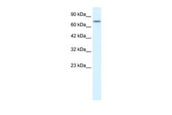 Aviva Systems Biology Corp RIPK1 Antibody - middle region (AVARP02038_P050)