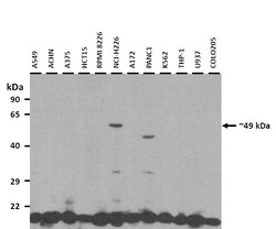 Aviva Systems Biology Corp TEAD2 Antibody - middle region (ARP30041_P050)