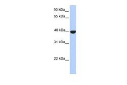 Aviva Systems Biology Corp ELK1 Antibody - N-terminal region (ARP31180_P050)