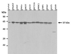 Aviva Systems Biology Corp RIPK3 Antibody - N-terminal region (ARP31513_T100)