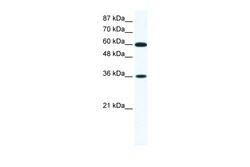 Aviva Systems Biology Corp FOXF1 Antibody - N-terminal region (ARP31691_T100)