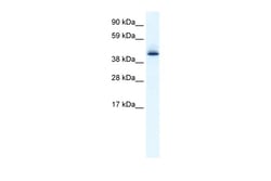 Aviva Systems Biology Corp AATF Antibody - N-terminal region (ARP31867_P050)