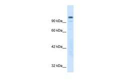 Aviva Systems Biology Corp GTF2I Antibody - N-terminal region (ARP31910_P050)