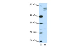 Aviva Systems Biology Corp GTF2I Antibody - N-terminal region (ARP31910_T100)