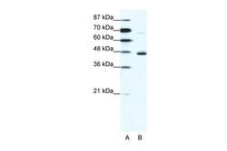 Aviva Systems Biology Corp NEUROD1 Antibody - N-terminal region (ARP32036_T100)