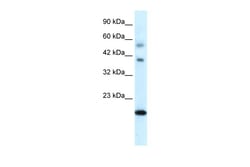 Aviva Systems Biology Corp CGI-143 Antibody - N-terminal region (ARP32073_P050)