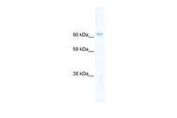 Aviva Systems Biology Corp PIK3CB Antibody - C-terminal region (ARP32117_T100)