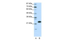 Aviva Systems Biology Corp TAF11 Antibody - N-terminal region (ARP32136_P050)