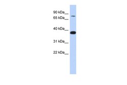 Aviva Systems Biology Corp ZNF526 Antibody - N-terminal region (ARP32148_P050)