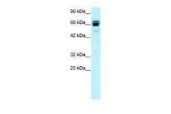 Aviva Systems Biology Corp RNF12 Antibody - C-terminal region (ARP32151_P050)