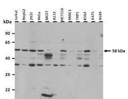 Aviva Systems Biology Corp EGR1 Antibody - N-terminal region (ARP32241_P050)