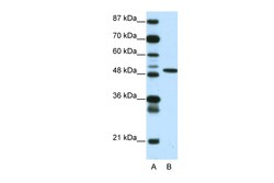 Aviva Systems Biology Corp ETV5 Antibody - N-terminal region (ARP32264_P050)