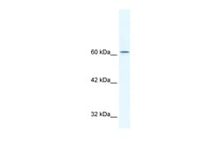 Aviva Systems Biology Corp TLE3 Antibody - N-terminal region (ARP32362_T100)