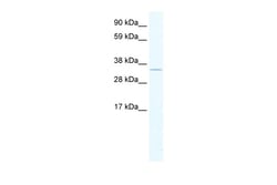 Aviva Systems Biology Corp SIRT2 Antibody - C-terminal region (ARP32385_P050)