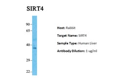 Aviva Systems Biology Corp SIRT4 Antibody - middle region (ARP32451_P050)