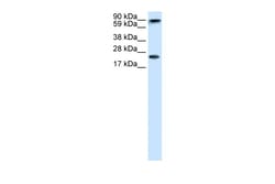 Aviva Systems Biology Corp CBX5 Antibody - middle region (ARP32481_T100)