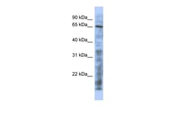 Aviva Systems Biology Corp HTATIP Antibody - N-terminal region (ARP32488_P050)