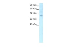 Aviva Systems Biology Corp FOSB Antibody - C-terminal region (ARP32519_T100)