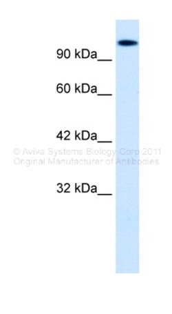 Aviva Systems Biology Corp HIPK2 Antibody - middle region (ARP32586_P050)