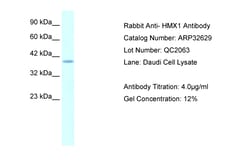 Aviva Systems Biology Corp HMX1 Antibody - middle region (ARP32629_T100)