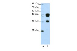Aviva Systems Biology Corp FOXA1 Antibody - C-terminal region (ARP32630_P050)
