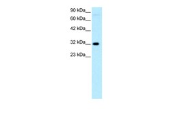 Aviva Systems Biology Corp MEOX1 Antibody - N-terminal region (ARP32697_P050)