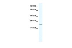 Aviva Systems Biology Corp HTATIP2 Antibody - N-terminal region (ARP32775_P050)