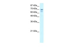 Aviva Systems Biology Corp HR Antibody - middle region (ARP32907_P050)