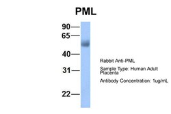 Aviva Systems Biology Corp PML Antibody - C-terminal region (ARP33048_P050)