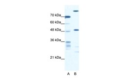 Aviva Systems Biology Corp NFS1 Antibody - middle region (ARP33115_T100)