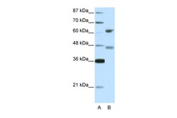 Aviva Systems Biology Corp RFX4 Antibody - middle region (ARP33224_T100)