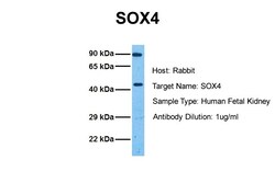 Aviva Systems Biology Corp SOX4 Antibody - N-terminal region (ARP33252_P050)