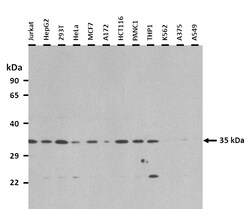 Aviva Systems Biology Corp SHOX2 Antibody - N-terminal region (ARP33285_P050)